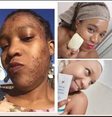 Servicing the Western Cape with all your Waterproofing Dampproofing issues