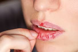 Picking Pulling Biting Body Damaging Disorders I'd say that if it helps you produce the sound, it's ok, but i'd use it as a. picking pulling biting body damaging