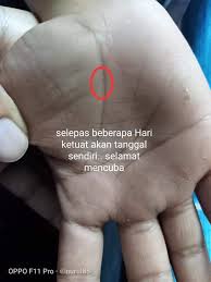 Metode latihan ini dipercaya akan memperkuat fisik dan juga stamina dari. Petua Hilangkan Ketuat Guna Daun Kesum Garam Memang Menjadi