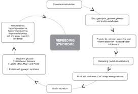 Image result for Refeeding Syndrome