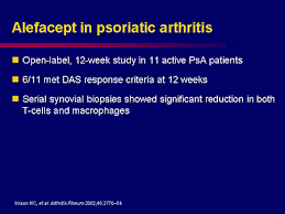 Image result for Poststreptococcal Reactive Arthritis