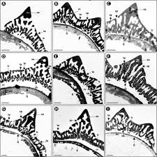 Image result for Philyrophyllum schinzii
