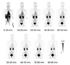 Pet is primarily used to diagnose cancer, cardiovascular disease, and neurologic disorders. Safety Of Novel Cancer Specific Pet Probe Confirmed In Clinical Research Eurekalert Science News
