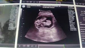 Bebes Gemelar Club De Bebes Mayo 2018 Babycenter