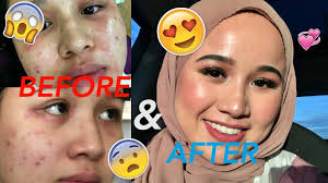 Earn 138.80 reward pointsrm81.60 rm69.40. The Skincare Routine That Fixed My Skin