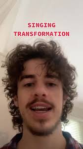 Whats with Will Austin