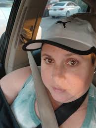 My xray! Shoulder replacement.