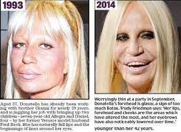 Leggi la biografia della stilista donatella versace e le curiosità sulla vita privata della sorella di gianni versace che ha disegnato anche il celebre vestito verde ma adesso donatella è tornata, proprio lei, avendo appena chiuso la sfilata della moda donna alla milano fashion week. Donatella Versace E Chirurgia Plastica L Incredibile Trasformazione Ladyblitz