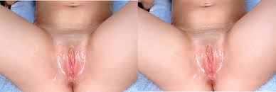 3D Nudes! Cross Your Eyes | MOTHERLESS.COM ™