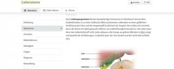 Gallensteine sind feste klumpen in der gallenblase die langsam immer größer werden und beschwerden wie schmerzen und koliken verursachen. Gallensteine Doccheck