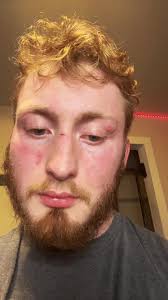 Go fund me link in my profile bio#help #gofundmehelp #ataxia #caregiver #fyp