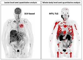 Photo :48 models set size : Ijms Free Full Text Pet Molecular Imaging A Holistic Review Of Current Practice And Emerging Perspectives For Diagnosis Therapeutic Evaluation And Prognosis In Clinical Oncology Html