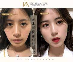See more of 香港蘋果日報 on facebook. è‹¹æžœè‚Œä¸‹åž‚äº†æ€Žä¹ˆåŠžä¸å¼€åˆ€ æ–°æ°§ç¾Žå®¹æ•´å½¢
