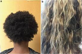 First of all, if that was the case people wouldn't need relaxers every two months. Developing A Healthy Hair Regimen Ii Transitioning To Chemical Free Styling To Natural Hair And Prevention Of Hair Trauma Springerlink