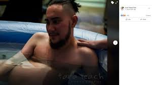 Konsumsi makanan mengandung vitamin c serta suplemennya dapat membantu dalam mempercepat penyembuhan luka sekaligus regenerasi kulit.anda juga perlu mengoleskan tabir surya pada bekas. Viral Pria Melahirkan Anak Ketiga Ini Foto Foto Persalinannya