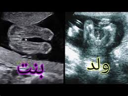 سونار البنت في الشهر الخامس انا الان في الشهر الخامس من الحمل