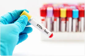 Addressing Your Concerns: Frequently Asked Questions About STD Testing in  Dubai - Oplexor
