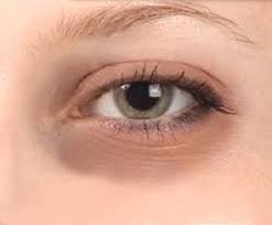 How To Get Rid Of Dark Circles Fast Top 10 Home Remedies Dark Eye Circles Dark Circles Under Eyes Dark Circle Remedies
