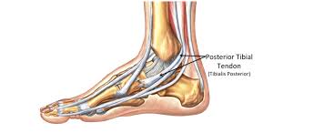 More images for tendonitis foot pain side of foot diagram » Tibialis Posterior Pain On The Inside Of The Ankle Pure Sports Medicine