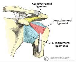 Impingement Syndrome Shoulder