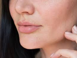 Kulit muka menipis sekiranya kita menggunakan skincare yang salah. Cara Memperkuat Skin Barrier Yang Terbukti Efektif