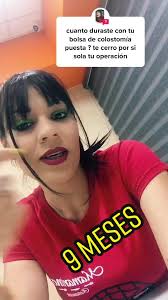 Mi experiencia tras una ileostomía: 9 meses difíciles