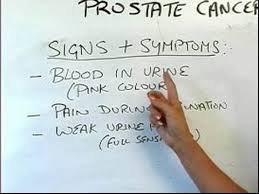 Thickening or swelling of part of the breast. Cancer Care Uk Care Guide