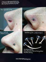 Wear Nopull Piercing Disc For Approximately 2 4 Weeks In Most Cases Www Nopullpiercing Com It Really Works When Piercing Bump Nose Piercing Bump Piercing