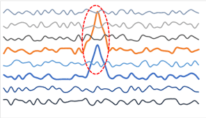 Something different, abnormal, peculiar, or not easily classified : Anomaly Detection As A Foundation Of Autonomous Monitoring