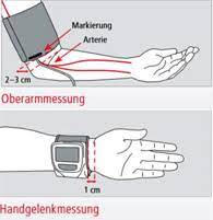 1 X 1 Der Blutdruckmessung