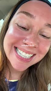 Invisalign: ¿Vale la pena a los 25 años?