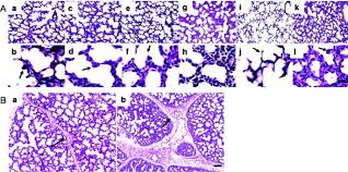 The fetal period extends from the third month through birth. Ventilation Of The Very Immature Lung In Utero Induces Injury And Bpd Like Changes In Lung Structure In Fetal Sheep Pediatric Research