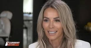 Married At First Sight Stacey Hampton unrecongisable with dissolved lip  fillers