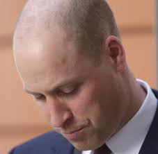Beide royals haben ein kleines problem mit ihrem haar. Prinz William Rasiert Sich Den Kopf Das Wurdevollste Mittel Gegen Haarausfall Ist Die Glatze Welt