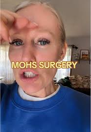#mohssurgery #surgerytok