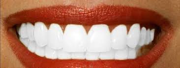 Blanchiment Dentaire Dentiste Roubaix Ou Blanchir Dent Maison Curcuma Avis Aguerris Marche A Suivre Reference Du Web Depuis 10 Ans