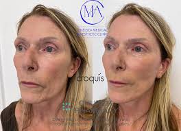 Chelsea Medical & Aesthetic Clinic