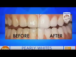 What is a philips zoom? Zoom Professional In Chair Teeth Whitening On Today Extra Philips Dental Professionals Youtube