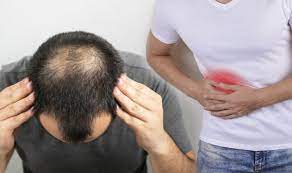 Loss of male distribution of hair. Fatty Liver Disease Diet Changes May Improve Your Liver Function And Help With Hair Loss Express Co Uk