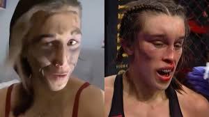 Born august 18, 1987) is a polish mixed martial artist who competes in the women's strawweight division of the ultimate fighting championship. Jak Wyglada Twarz Jedrzejczyk Na Tydzien Po Walce Z Zhang Wideo Polsat Sport