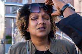 NYC subway-beating vic reveals injuries and issues plea to Adams