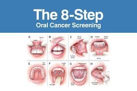 According to nhs, a cyst on tonsil could be a tumor. Mouth Cancer Symptoms Risks And Checkup Bow Lane Dental Group