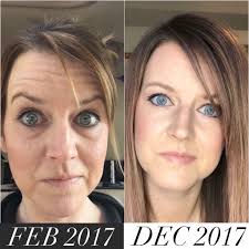 Confidence and glow at 43 without botox or fillers