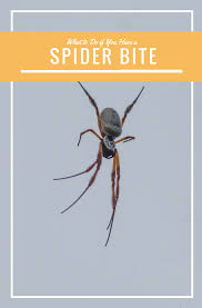 What To Do If You Have A Spider Bite Spider Bites Spider Bitten