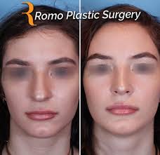 Thomas Romo III M.D. is one of the...