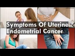 Before your doctor decides your stage, they'll use tests, such as a biopsy and ultrasound, to find what type of uterine cancer you have. What Were Your First Symptoms Of Uterine Cancer Uterine Cancers About Womens Cancer That Surgery Was Because My Gyn Had Found Uterine Cancer