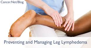 For the earliest stages of cervical cancer, when the cancer is localized in the cervix, surgery, or radiation combined with chemo may be used. Lymphedema Cancer Net