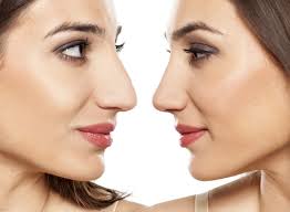 East Bay Hand & Upper Extremity| Hand Surgeons Oakland CA