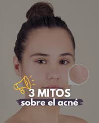 Mitos sobre el acné que deberíamos dejar atrás ❌ En redes, charlas o  incluso en el día a día, seguimos escuchando frases como: ▪️ “Es solo cosa  de adolescentes” ▪️ “Es por