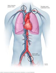 Pin On Medical